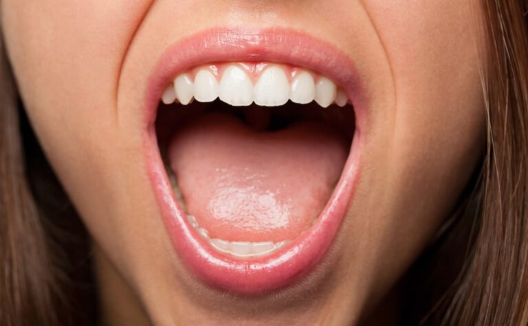Lire la suite à propos de l’article Tout savoir sur l’assainissement parodontal : le traitement qui peut sauver vos dents