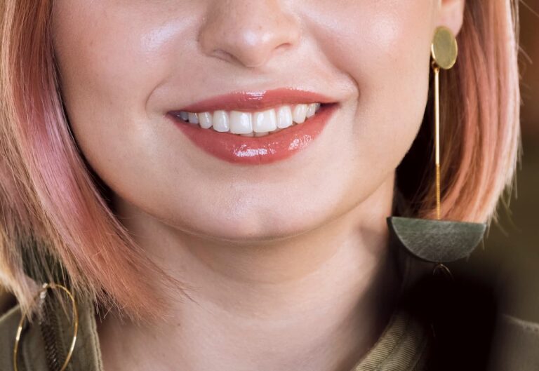Lire la suite à propos de l’article Taches blanches sur les dents : causes, solutions et traitements efficaces