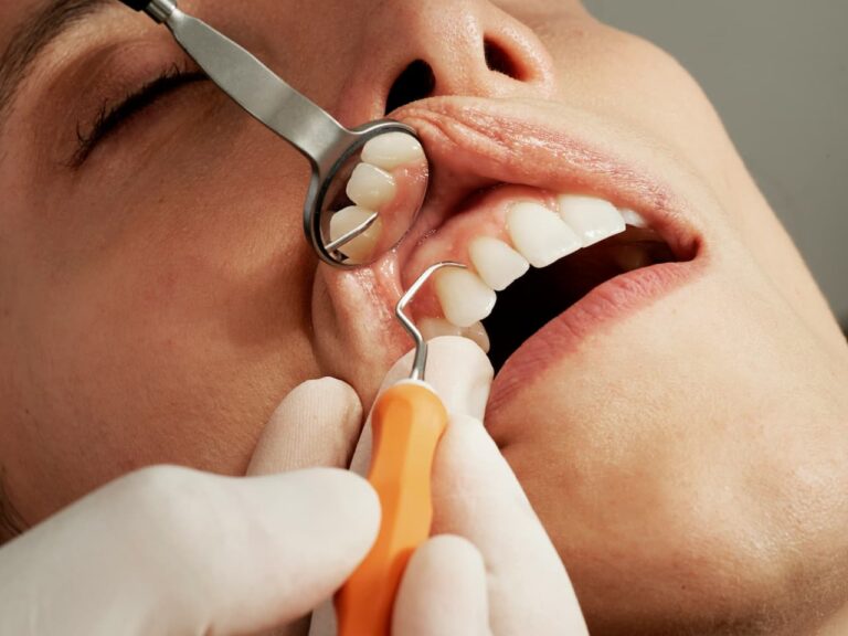 Lire la suite à propos de l’article Dent qui bouge avec le doigt : causes, risques et solutions