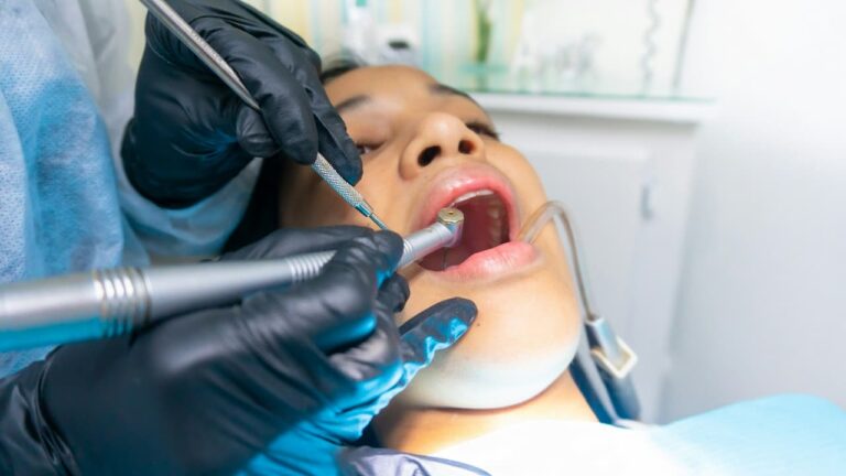 Lire la suite à propos de l’article Extraction de dents de sagesse : Combien de temps dure la douleur et la cicatrisation ?