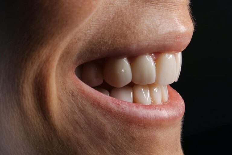 Lire la suite à propos de l’article Comment enlever le tartre des dents : les méthodes efficaces et sans risque