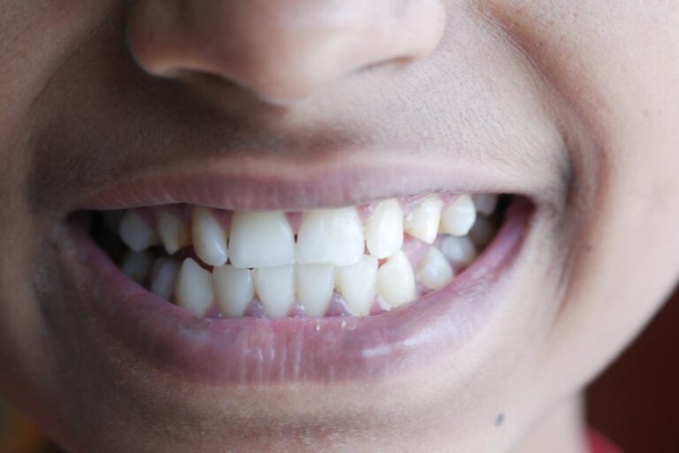 Lire la suite à propos de l’article Astuce de grand-mère pour enlever le tartre des dents : 5 remèdes naturels testés et approuvés