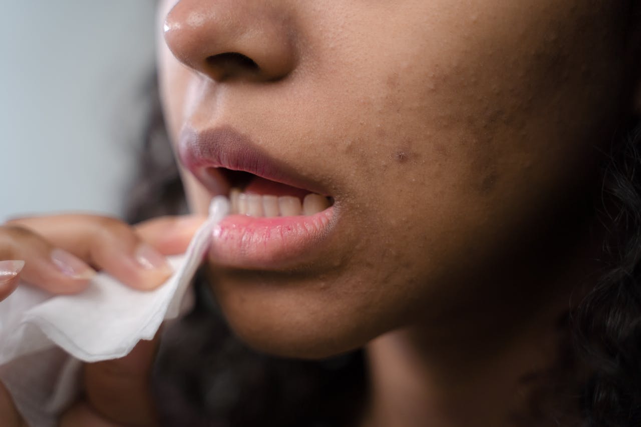 You are currently viewing Médicament pour aphte sans ordonnance : lequel choisir en pharmacie ?