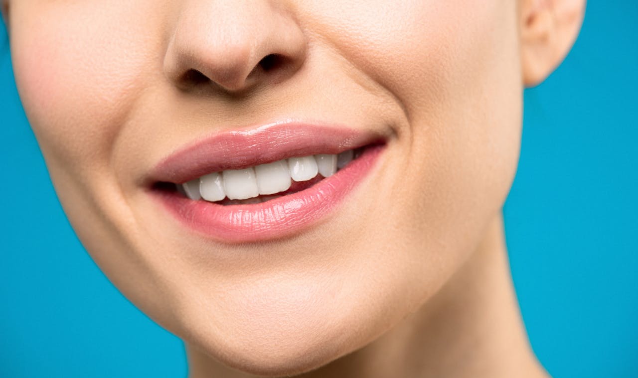 You are currently viewing Trou entre les dents après détartrage : pourquoi et que faire ?