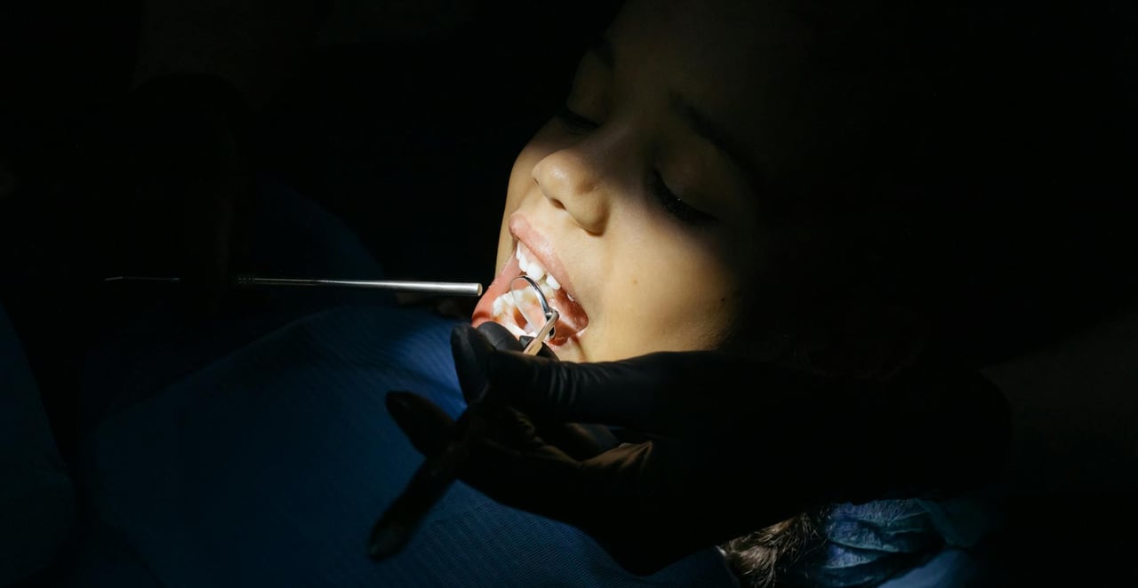 You are currently viewing Racine de dent de lait : anatomie, résorption et que faire quand elle persiste