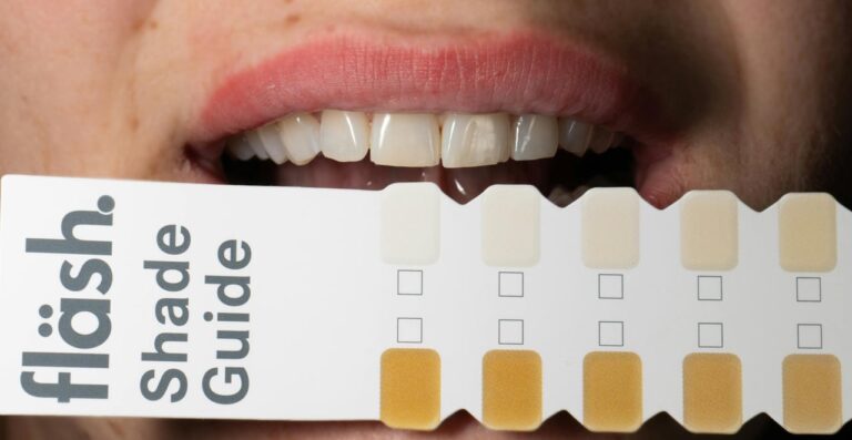 Lire la suite à propos de l’article Tache noire sur les dents : causes, traitements et prévention