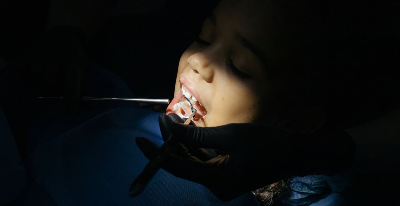 You are currently viewing Dent qui pousse derrière dent de lait : causes, risques et solutions