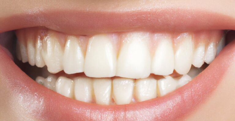 Lire la suite à propos de l’article Dentifrice pour gencives qui saignent : comment choisir le bon ?