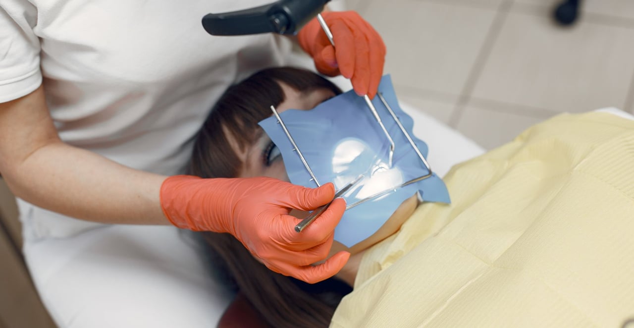 You are currently viewing Comment le dentiste soigne une carie