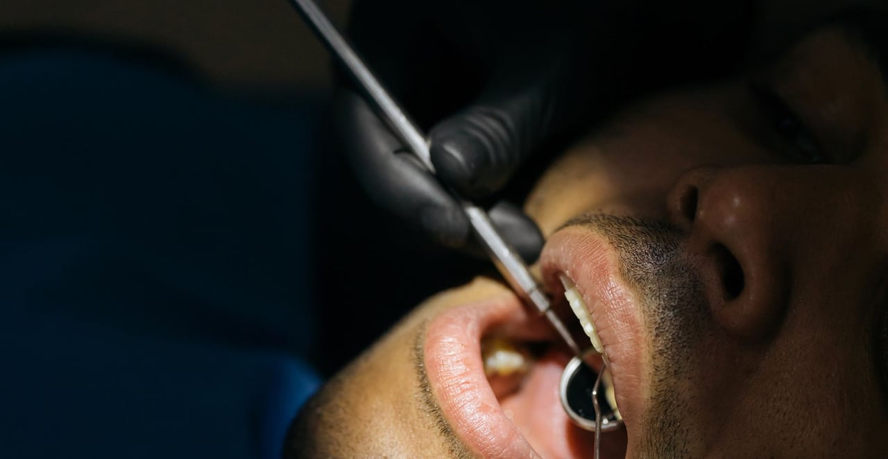 You are currently viewing Petite boule sur la lèvre ou dans la bouche : causes et traitements